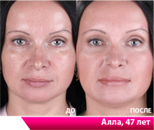 Каждая женщина хочет выглядеть молодой и красивой в любом возрасте.