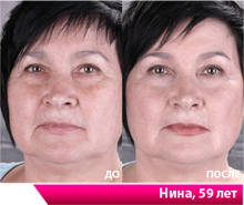 Крем вернул мне радость жизни, я с улыбкой просыпаюсь утром!