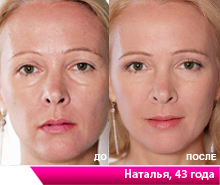 Каждая женщина хочет выглядеть молодой и красивой в любом возрасте.