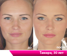 Я просто очарована кремом Стэм Сэлл Терапи!